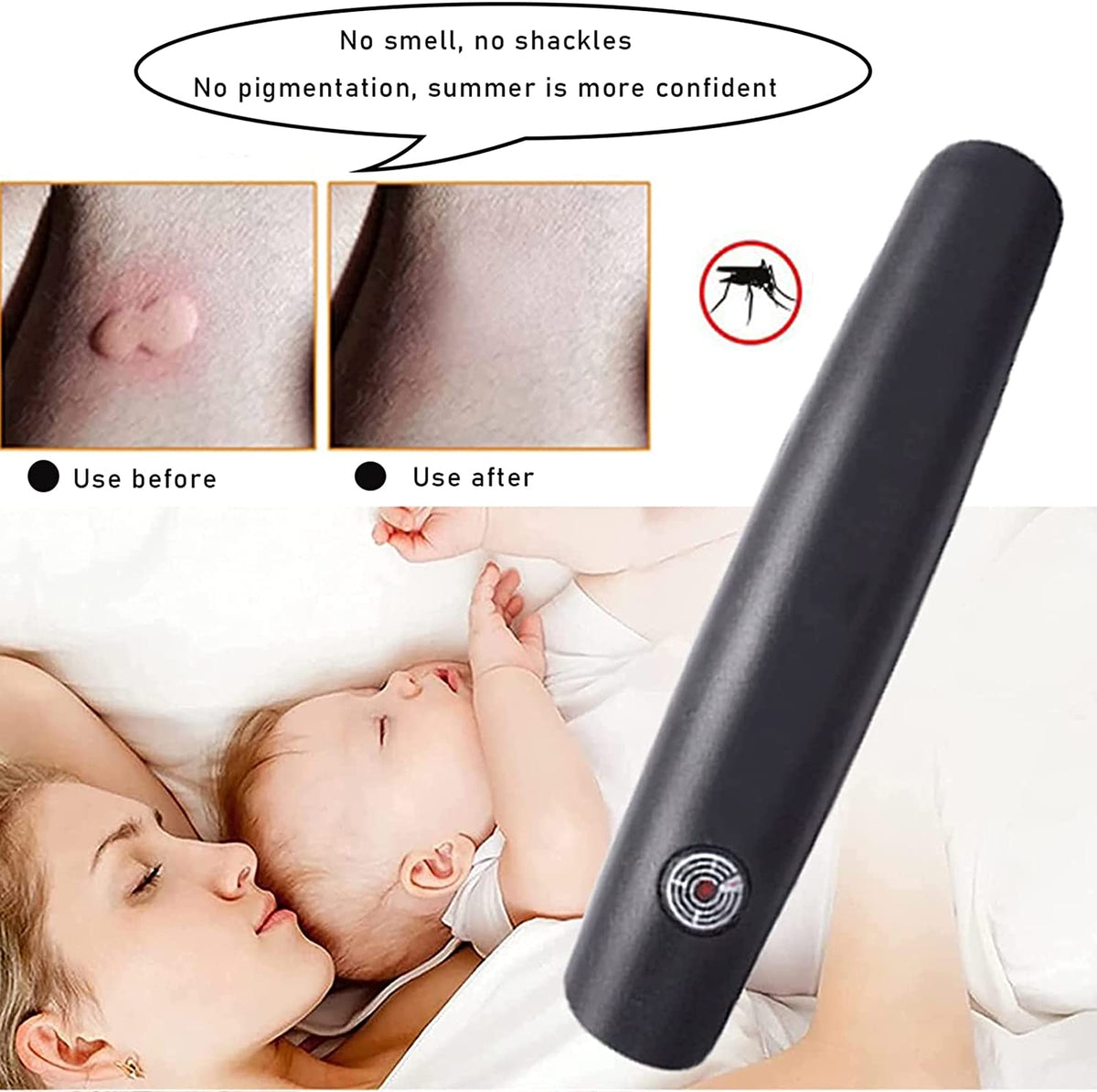 Mosquito bite helper for quick itch relief